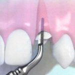 tecnología clínica dental en Terrassa