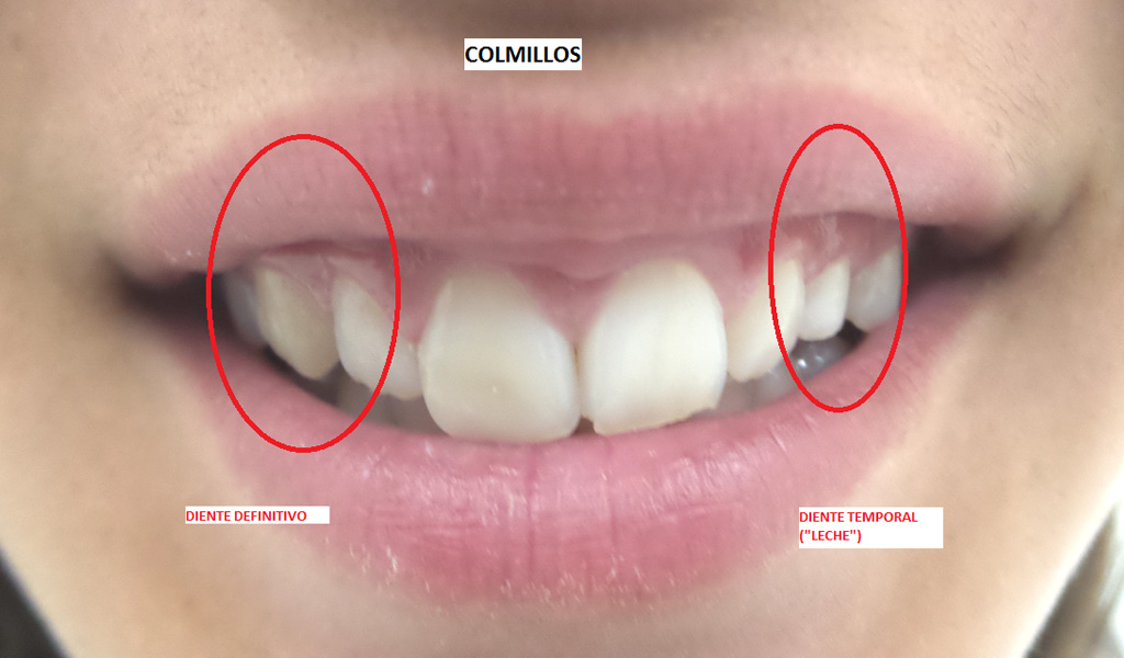 caso real ortodoncia