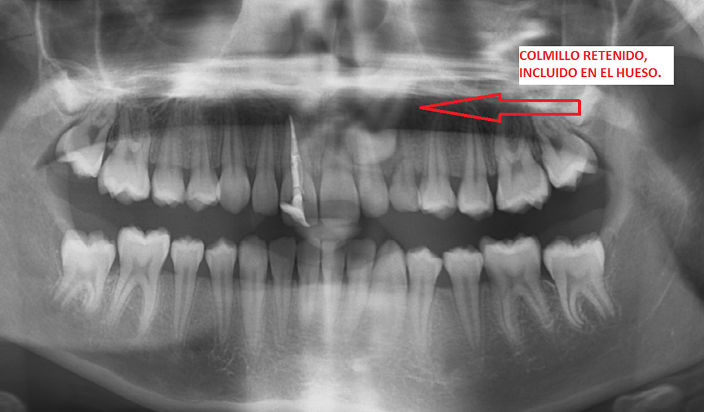 caso real ortodoncia