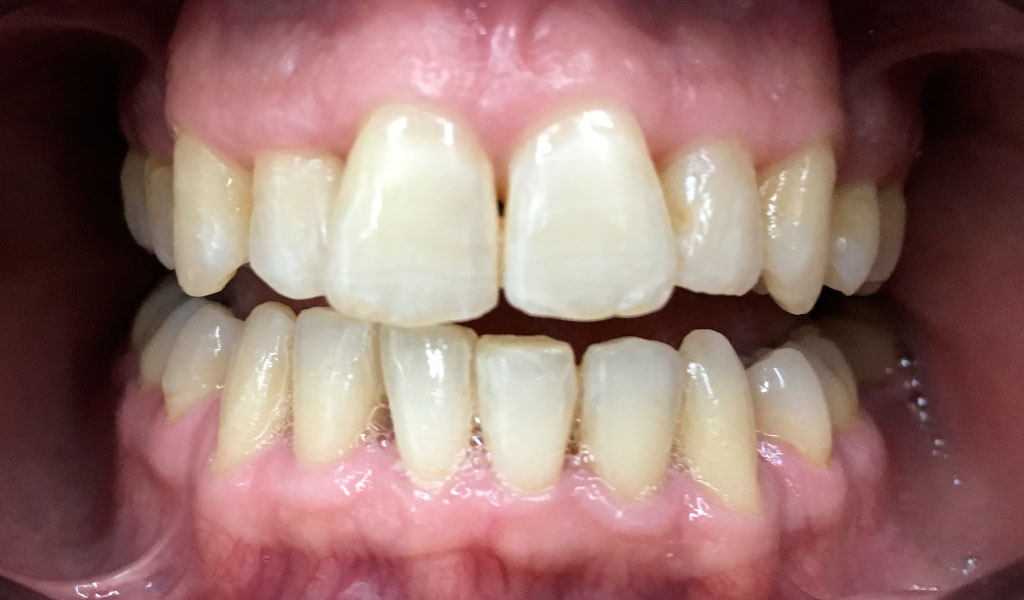 caso real de ortodoncia