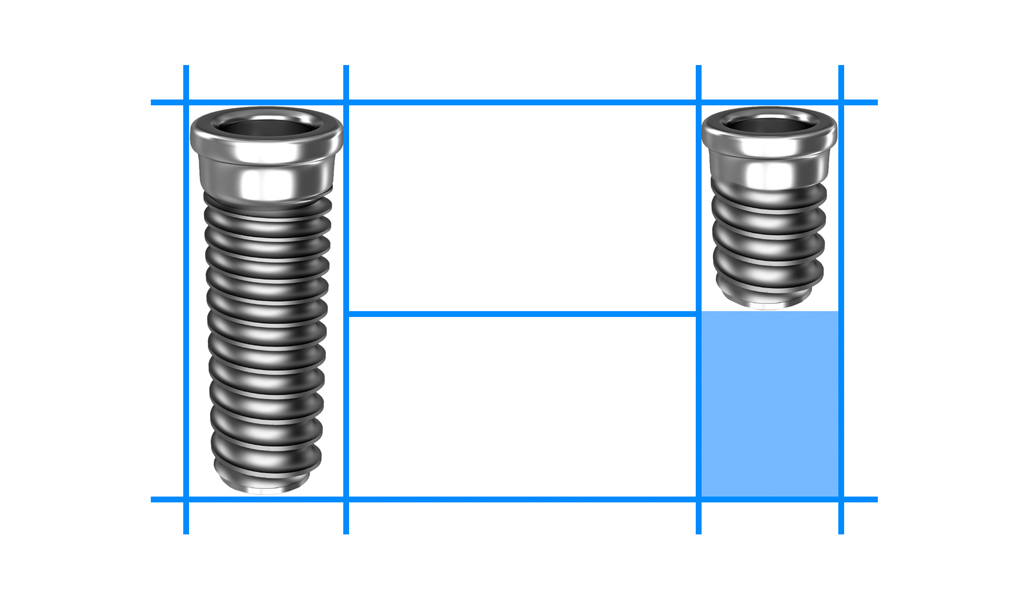 implantes cortos