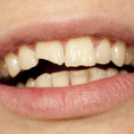 área de prótesis dental en Terrassa