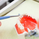 área de prótesis dental en Terrassa