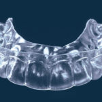 área de prótesis dental en Terrassa